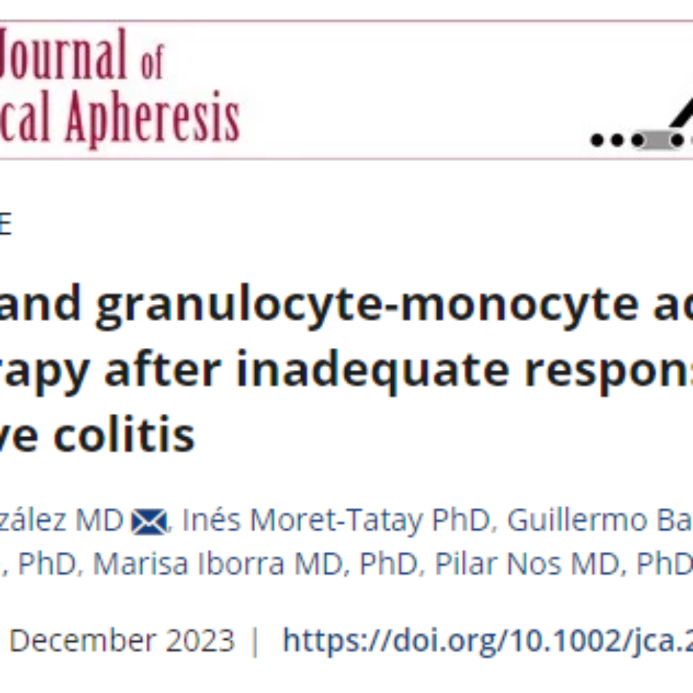 Publicación del estudio realizado en nuestro Hospital sobre granulocitoaféresis en la colitis ulcerosa